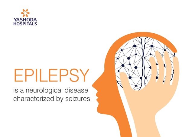 Can anxiety cause seizures without epilepsy?