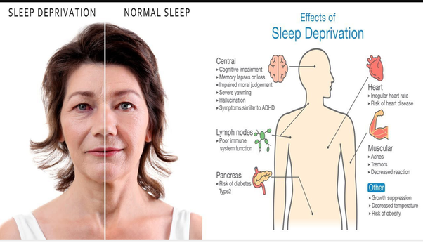 Can sleep deprivation cause anxiety?