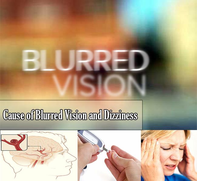 Cause of Blurred Vision and Dizziness