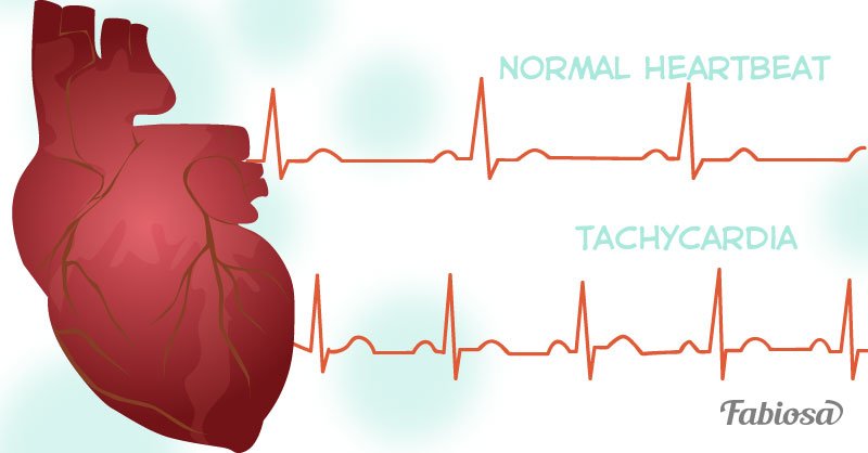 Fast Heart Rate: 11 Possible Causes And When To Worry