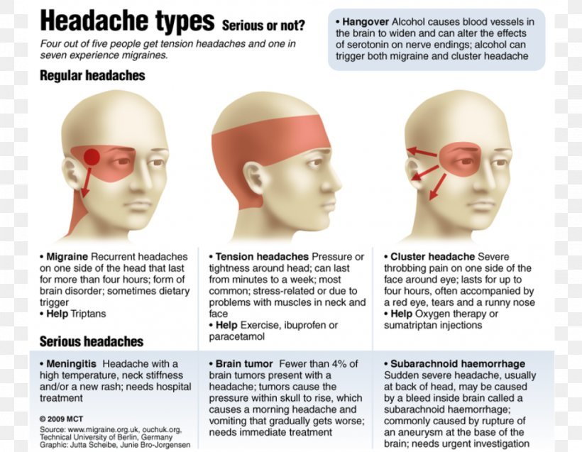 Headache Disease Eye, PNG, 1024x796px, Headache, Ache ...