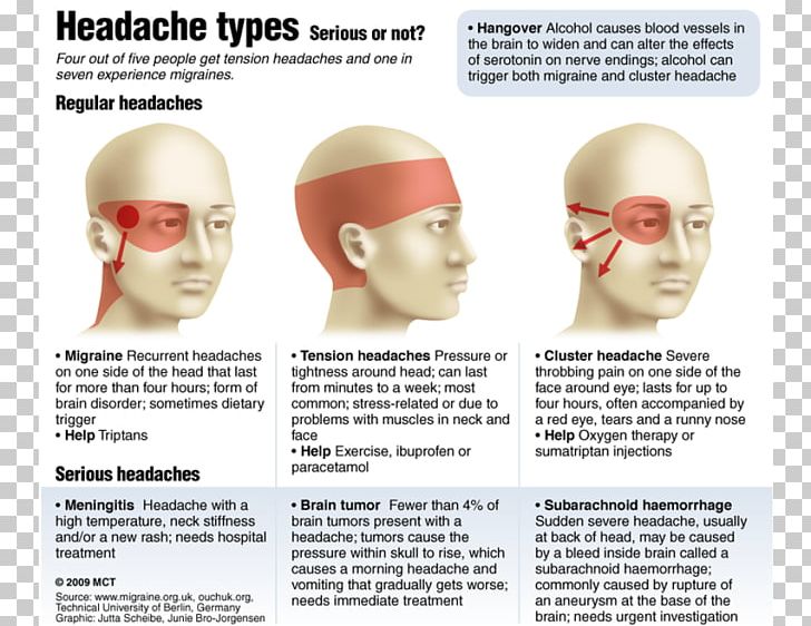 Headache Disease Eye PNG, Clipart, Ache, Anxiety, Arakhis ...
