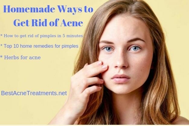 Homemade Ways to Get Rid of Acne