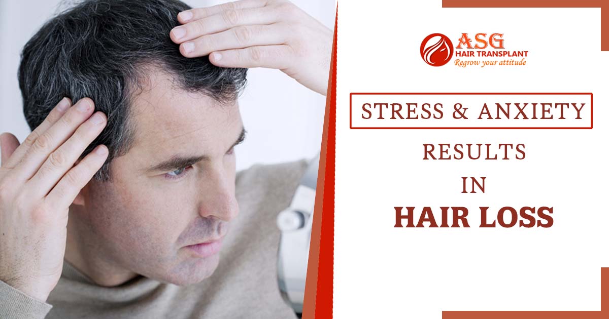 How stress and anxiety can cause hair loss issues?
