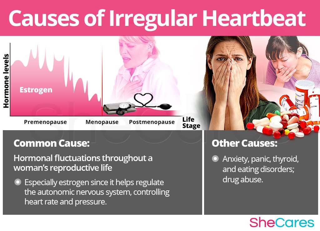 Irregular Heartbeat Shecares