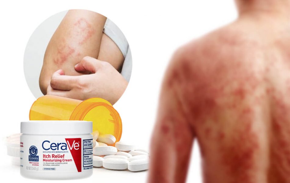 Random Itching All Over Body: The Main Cause And How To ...
