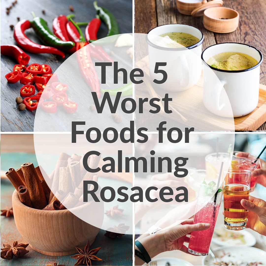 The 5 Worst Trigger Foods For Calming Rosacea Prone Skin